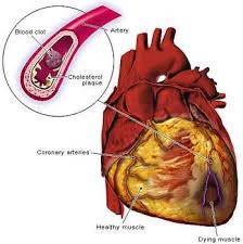 how to reduce heart diseases